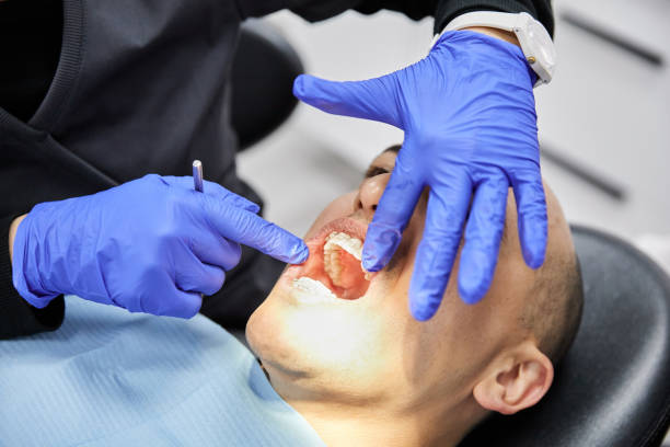 Best Emergency Dental Care for Broken or Chipped Teeth in Highlandville, MO